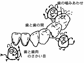図：歯と歯の間や歯と歯ぐきのさかい目、歯の噛み合わせ
