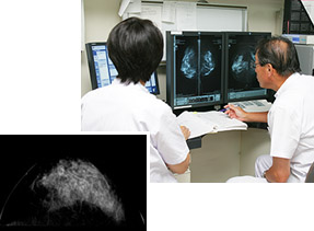 写真：乳房X線写真（頭尾方向）と専門医による判定の様子