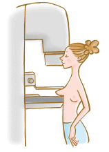 図：乳房のX線撮影